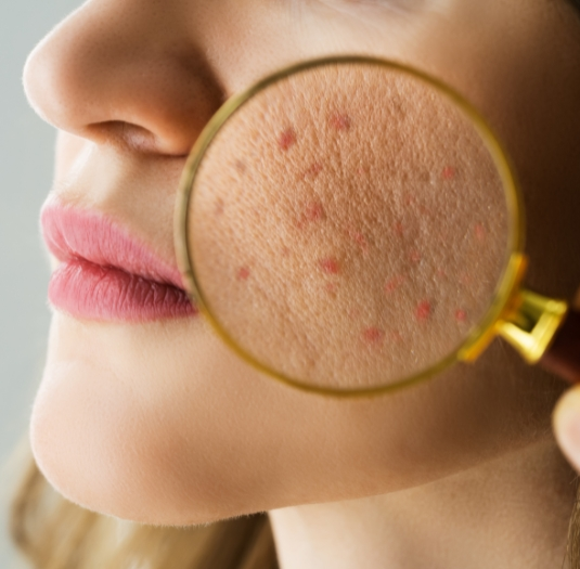 Skin Microbiome